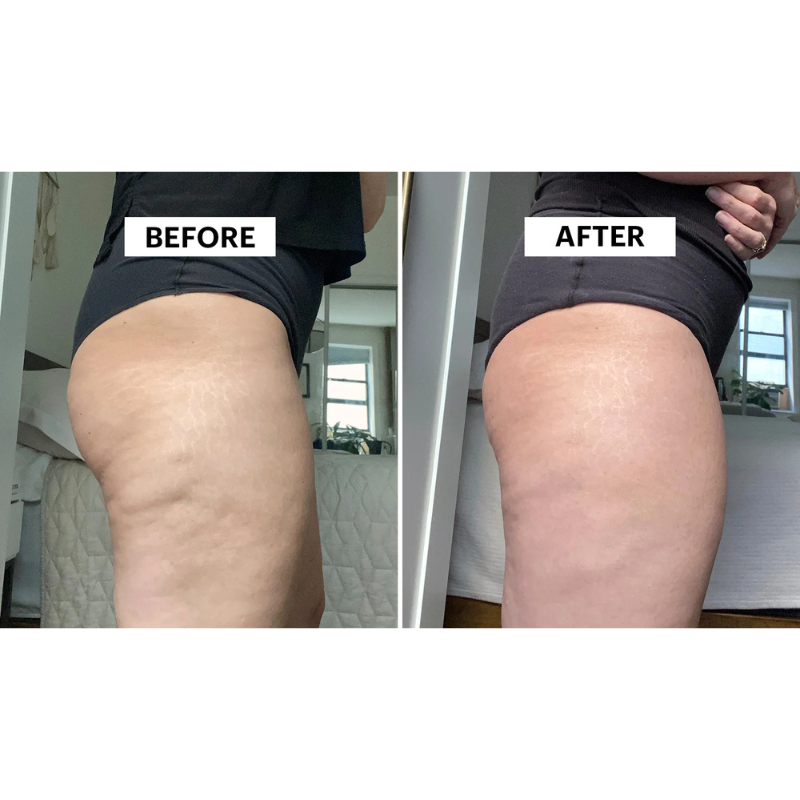 The Only Oil That Smooths Away Cellulite While You Sleep